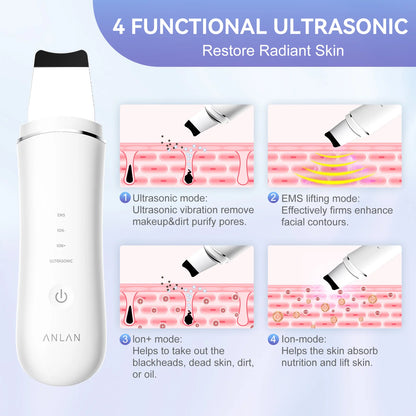 Anlan-Ultrasonic Skin Scrubber,EMS Face Lifting