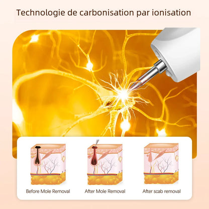 Plasma laser pen, skin tag remover