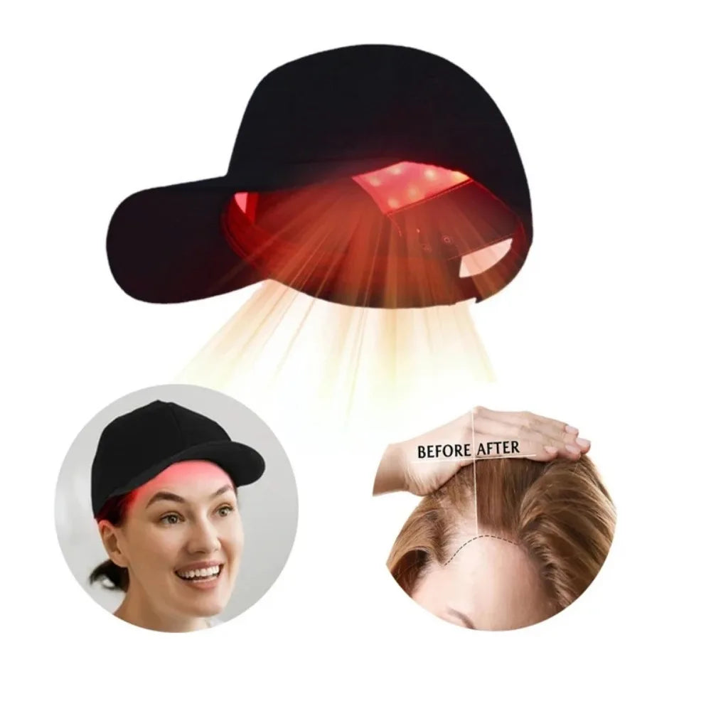 ZONGKUNG-Red Light Hair Growth Cap