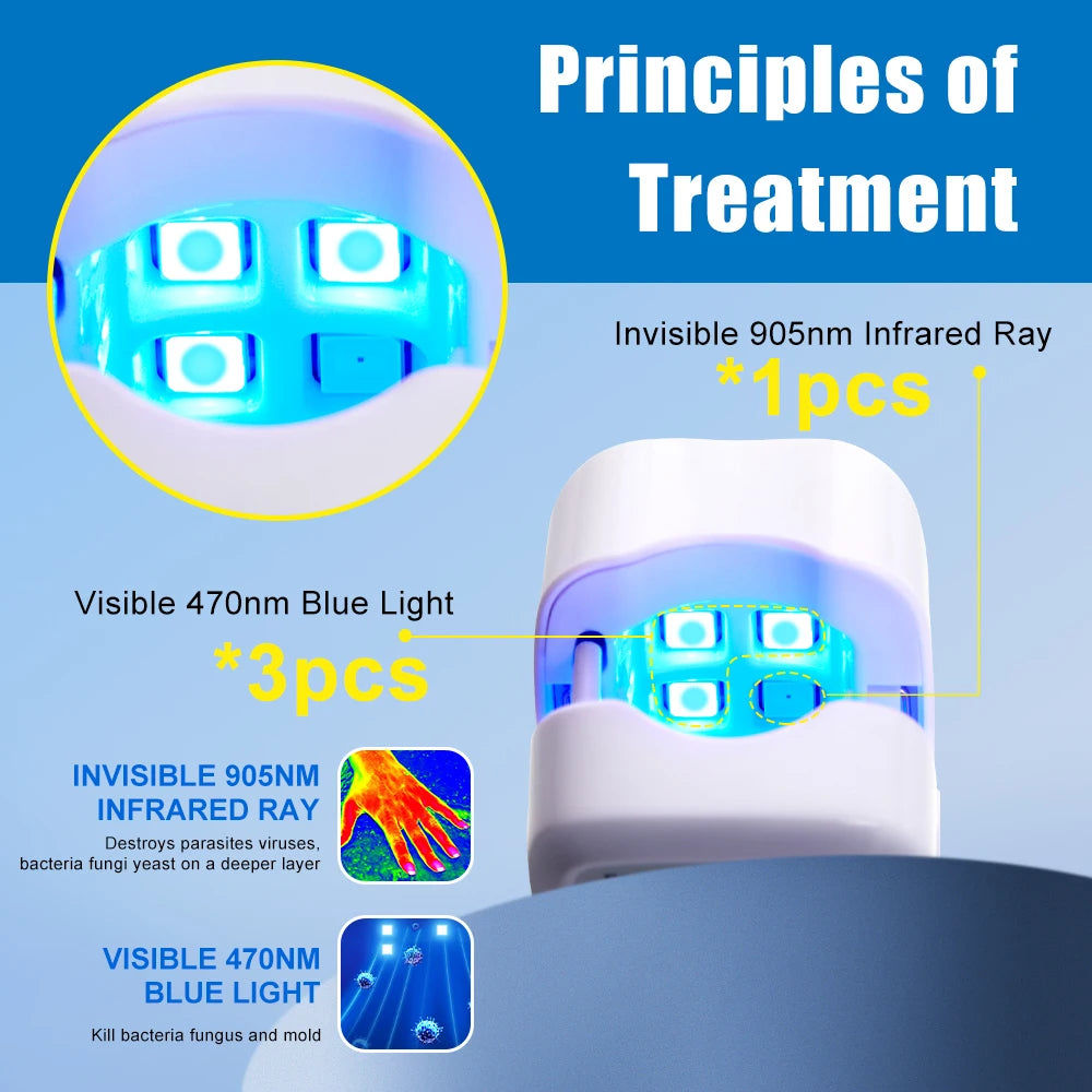 Laser Treatment Device for Nail Fungus Repair