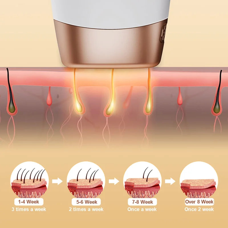 Oumonoka-IPL Laser-Epilierer für Frauen