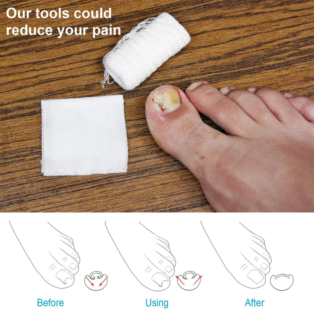 1 Pair Gel Toe Protector Pads