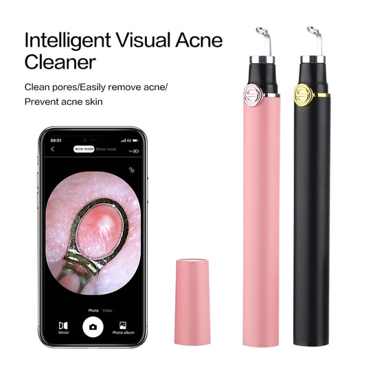 Smart Visual Acne Cleanser