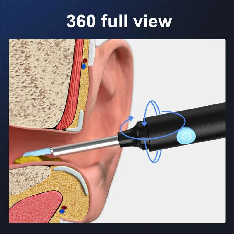 Ohrreinigungsstab mit Endoskopkamera