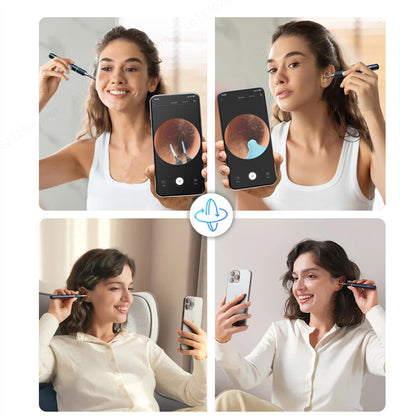 Bebird Note5 Pro-Smart Ear Cleaner