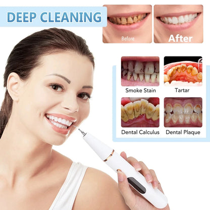 Ultrasonic dental scaler for tooth stains