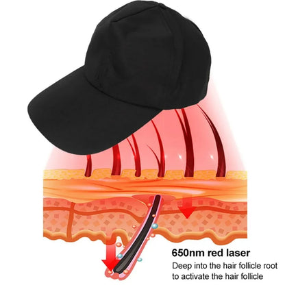 ZONGKUNG-Red Light Hair Growth Cap