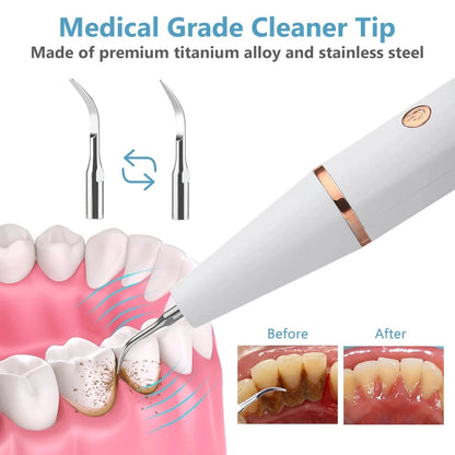 Ultrasonic dental scaler for tooth stains