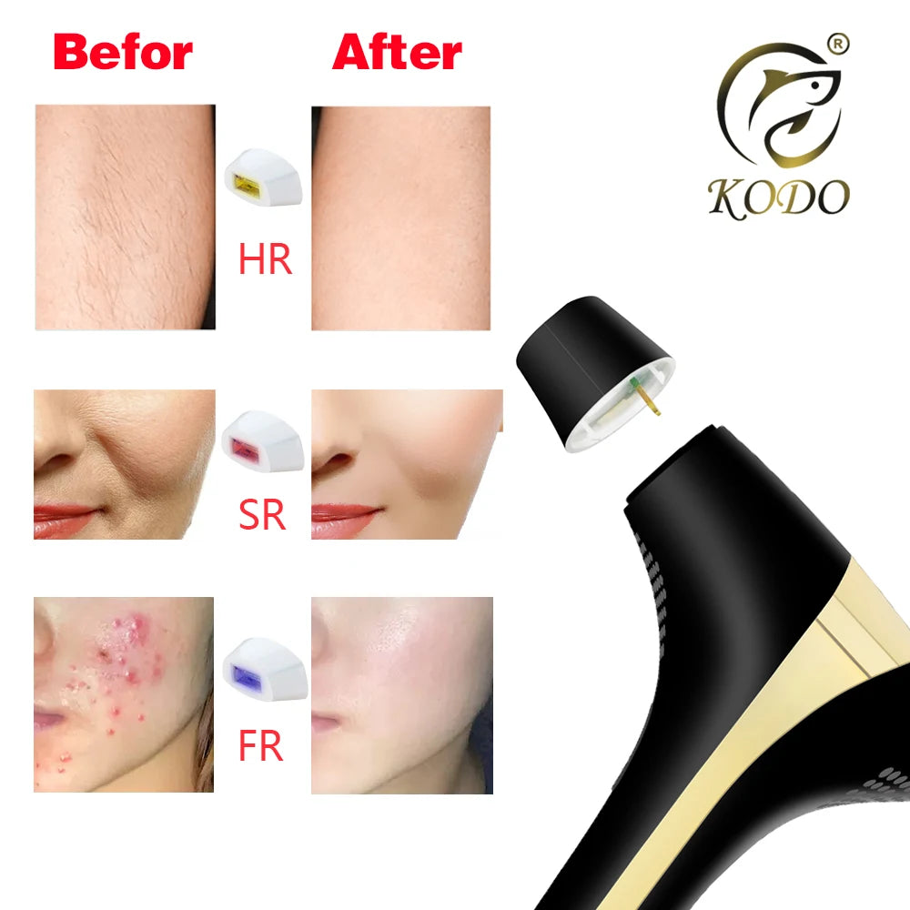 KODO-Épilateur laser sans douleur IPL en continu