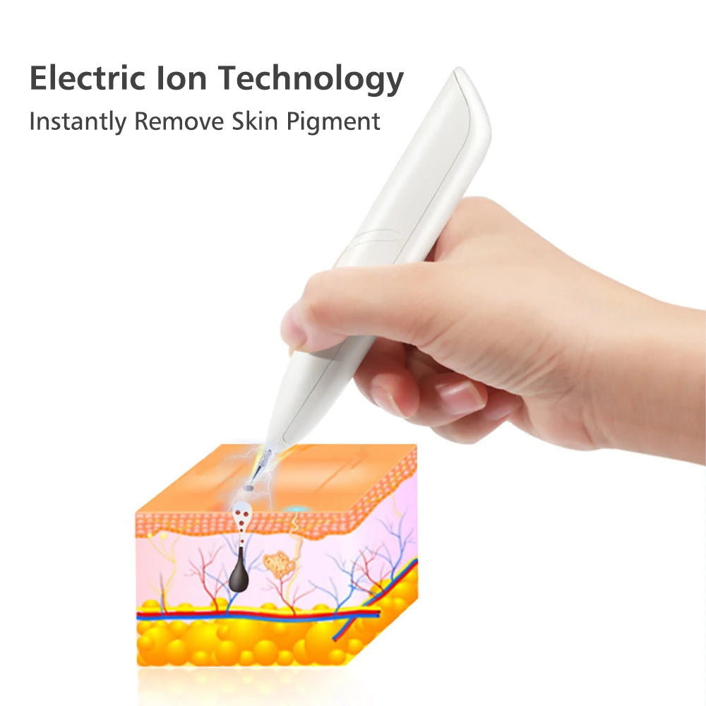 Laser pen for mole removal