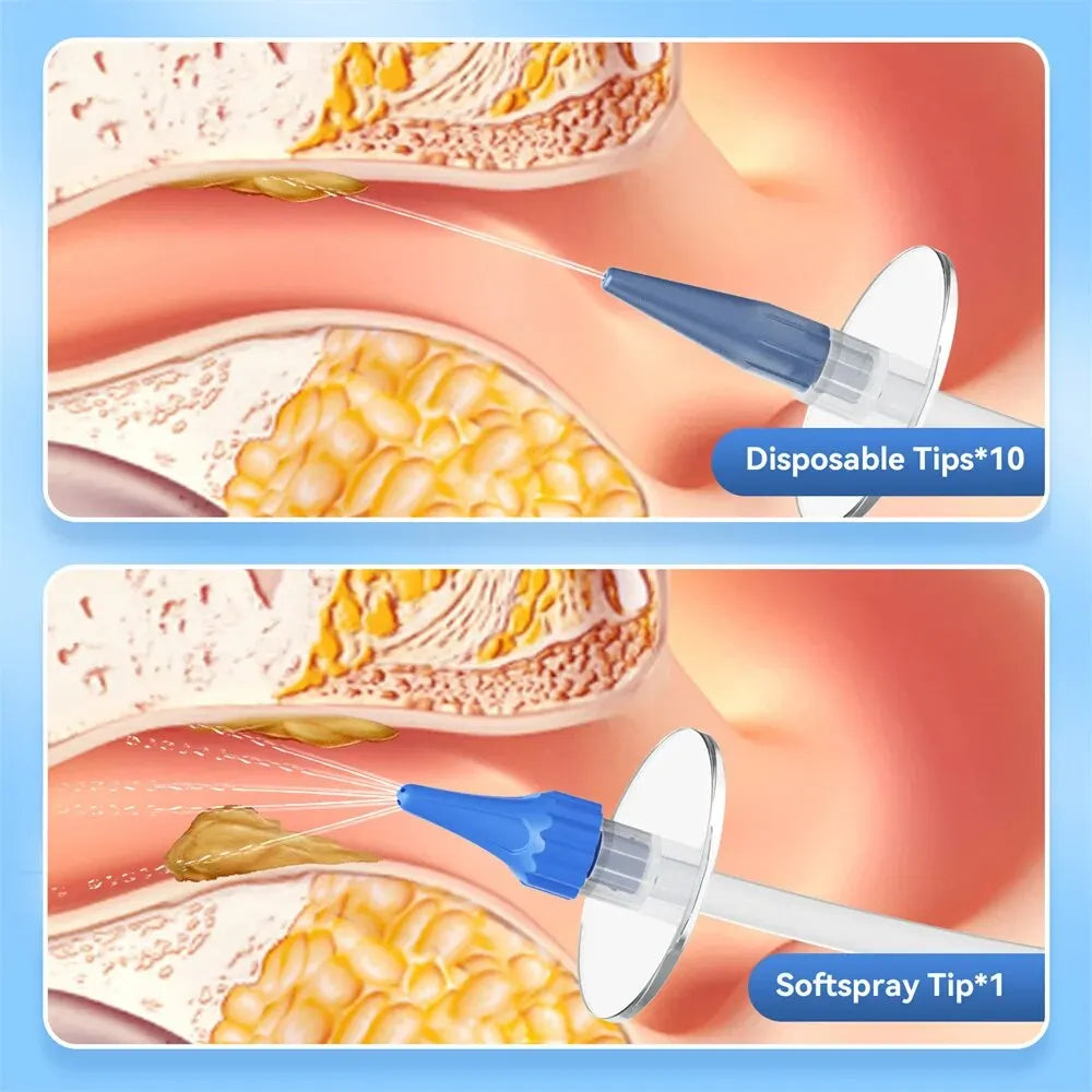 Ohrenschmalz-Entfernungsset