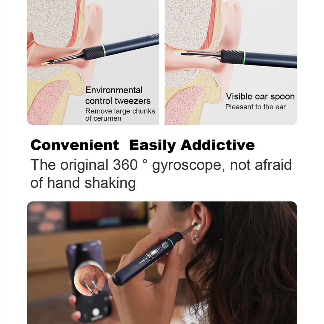 Bebird Note5 Pro-Smart Ear Cleaner