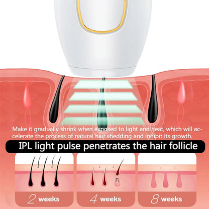 Épilateur laser professionnel permanent IPL