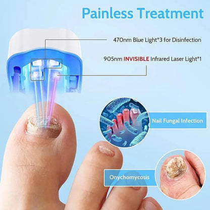 Laser Treatment Device for Nail Fungus Repair