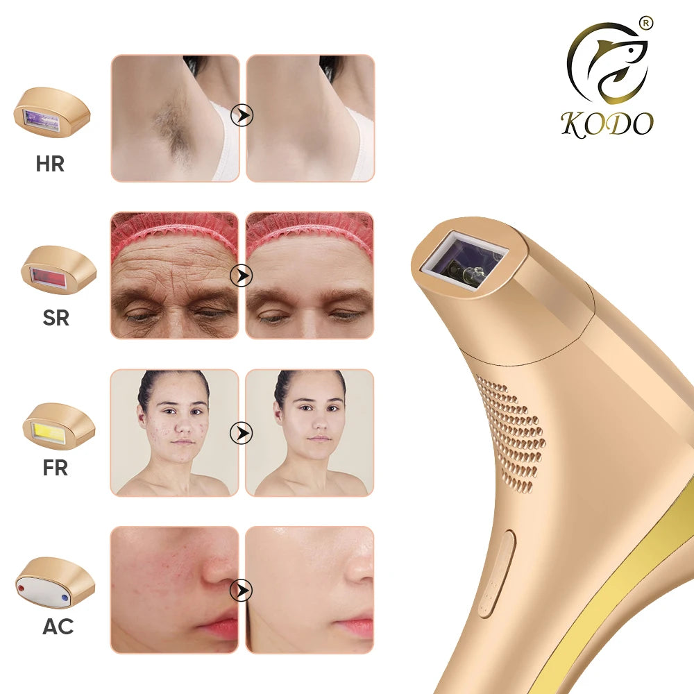 KODO-4 in 1 Laser-Epilierer, High-End